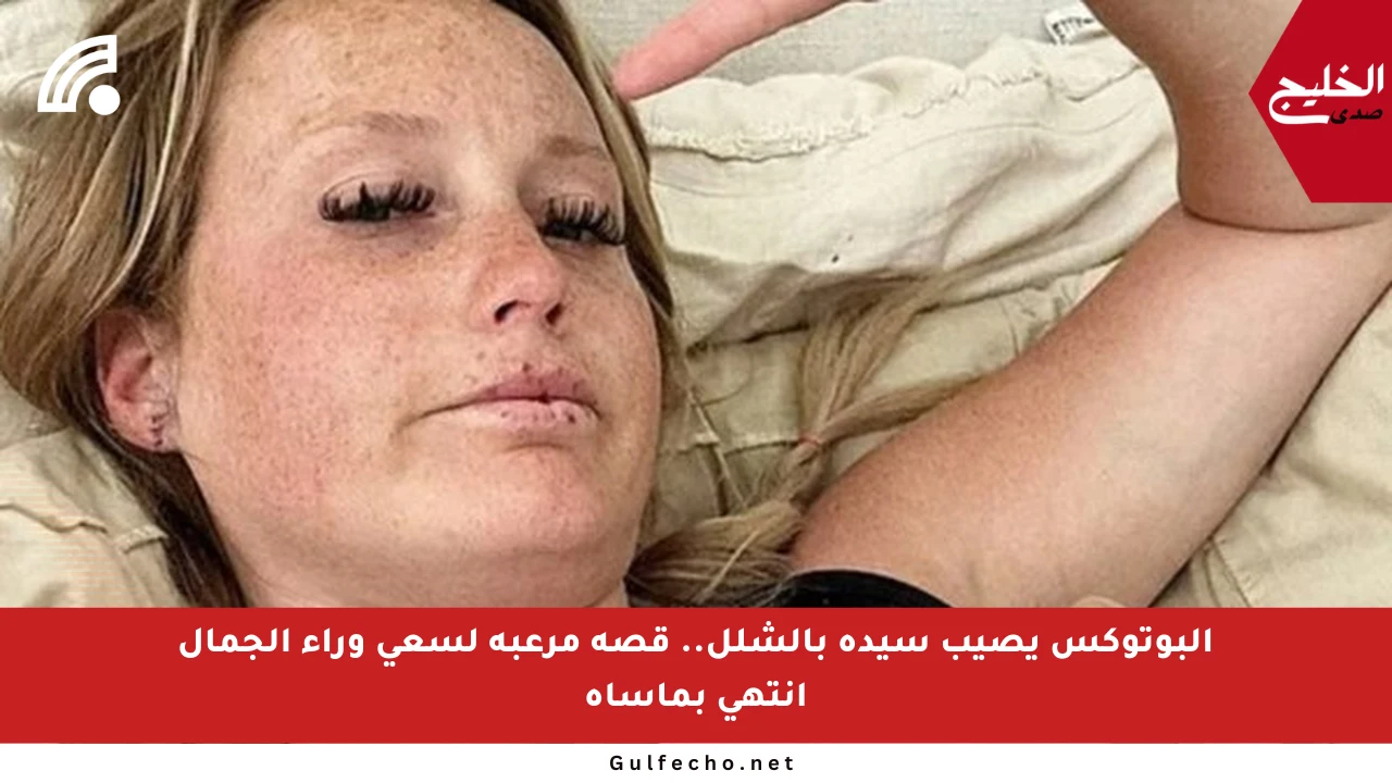 البوتوكس يصيب سيدة بالشلل.. قصة مرعبة لسعي وراء الجمال انتهى بمأساة